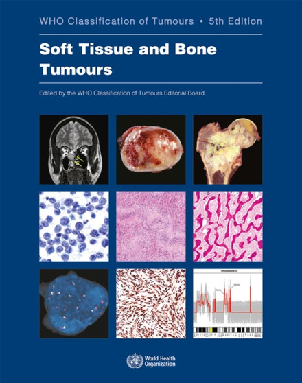 WHO classification of tumours of soft tissue and bone tumours : 3 by International Agency for Research on Cancer - Paperback
