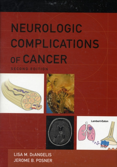 Neurologic Complications of Cancer by Lisa M. DeAngelis - Hardback