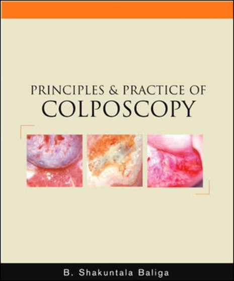 Principles and Practice of Colposcopy by B.Shakuntala Baliga - Hardback Principles and Practice of Colposcopy by B.Shakuntala Baliga - Hardback
