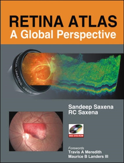Retina Atlas: A Global Perspective by Sandeep Saxena - Hardback