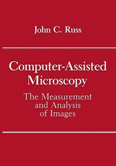 Computer-Assisted Microscopy : Measurement and Analysis of Images by John C. Russ - Hardback