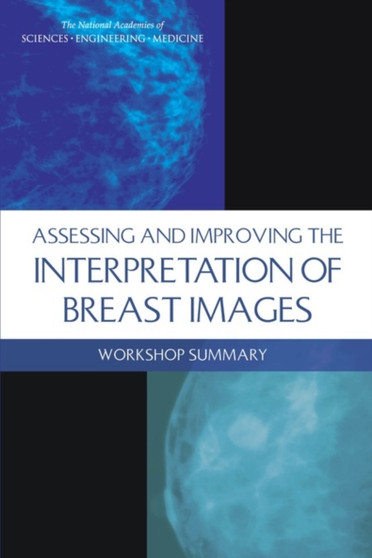 Assessing and Improving the Interpretation of Breast Images : Workshop Summary by Engineering and Medicine National Academies of Sciences - Paperback