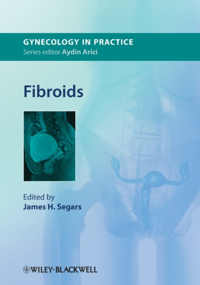 Fibroids by James H. Segars - Hardback