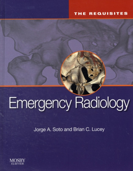 Emergency Radiology : The Requisites by Jorge A. Soto - Hardback