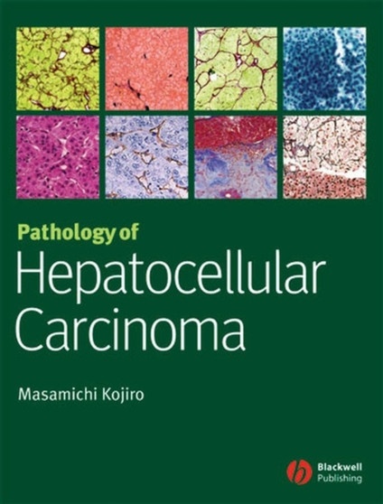 Pathology of Hepatocellular Carcinoma by Masamichi Kojiro - Hardback