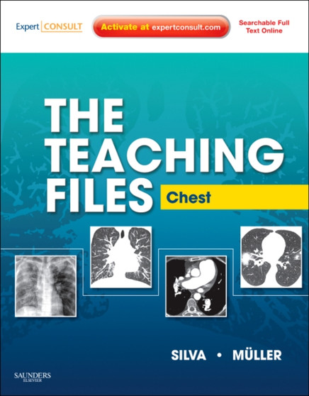 The Teaching Files: Chest : Expert Consult - Online and Print by Nestor L. MD PhD Muller - Hardback