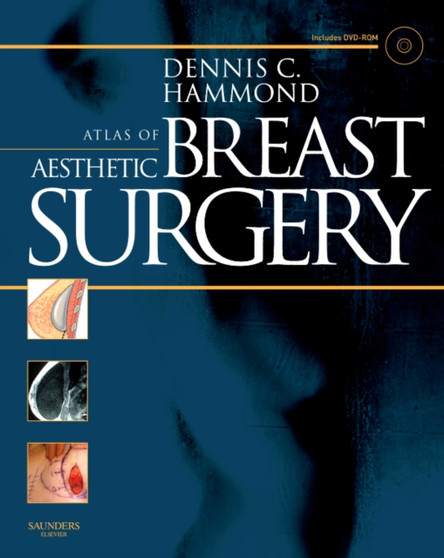 Atlas of Aesthetic Breast Surgery by Dennis C. Hammond - Hardback