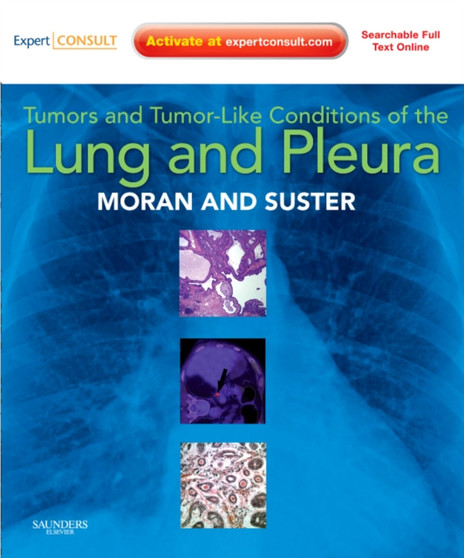 Tumors and Tumor-like Conditions of the Lung and Pleura : Expert Consult: Online and Print by Cesar A. Moran - Hardback