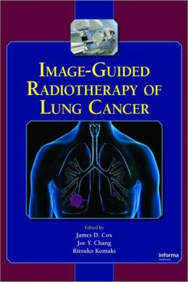 Image-Guided Radiotherapy of Lung Cancer by James D. Cox - Hardback
