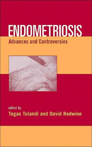 Endometriosis : Advances and Controversies by Togas Tulandi - Hardback