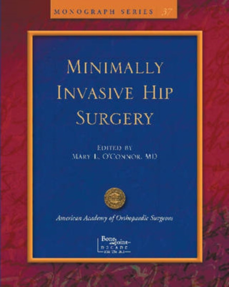 Limited Incisions for Total Hip Arthroplasty : Minimally Invasive Hip Surgery by Mary O'Connor - Paperback