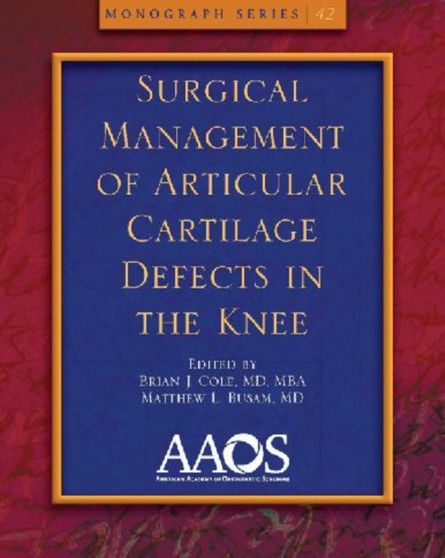 Surgical Management of Articular Cartilage Defects in the Knee by Brian J. Cole - Paperback
