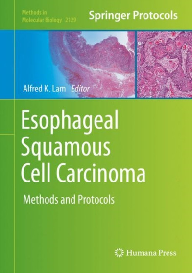 Esophageal Squamous Cell Carcinoma : Methods and Protocols : 2129 by Alfred K. Lam - Hardback