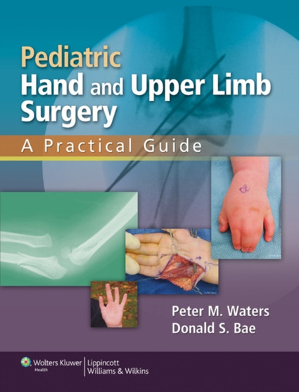 Pediatric Hand and Upper Limb Surgery : A Practical Guide by Peter M MD Waters - Hardback