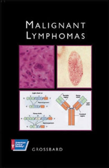 MALIGNANT LYMPHOMAS by GROSSBARD - Hardback