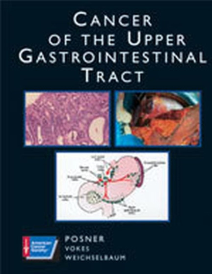 Cancer of the Upper Gastrointestinal Tract by Mitchell Posner - Hardback