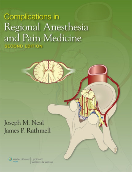Complications in Regional Anesthesia and Pain Medicine by Joseph MD Neal - Hardback