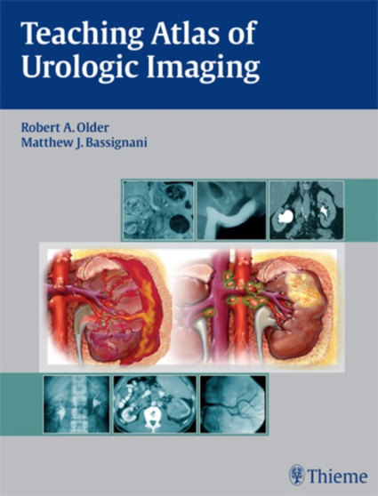 Teaching Atlas of Urologic Imaging by Robert Older - Hardback