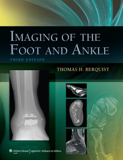 Imaging of the Foot and Ankle by Thomas H. MD FACR Berquist - Hardback