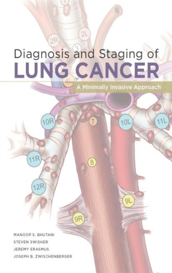 Diagnosis and Staging of Lung Cancer: A Minimally Invasive Approach by Manoop S. Bhutani - Paperback