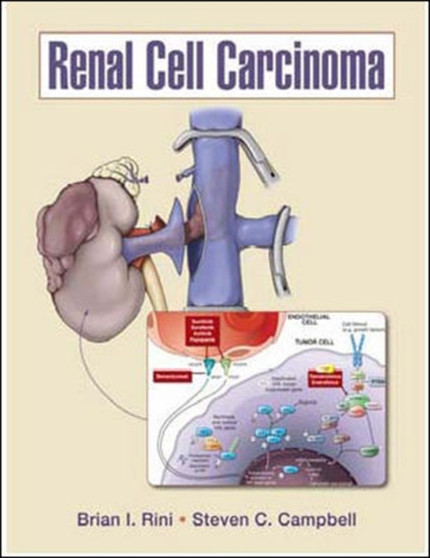 Renal Cell Carcinoma by Brian Rini - Hardback