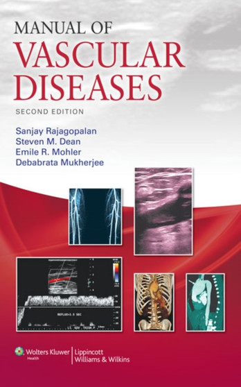 Manual of Vascular Diseases by Sanjay Rajagopalan - Paperback