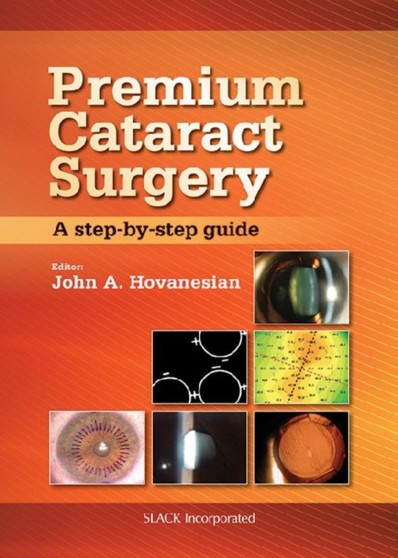 Premium Cataract Surgery : A Step-by-Step Guide by John Hovanesian - Hardback