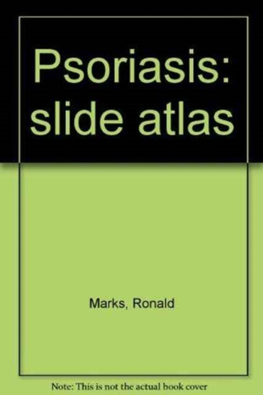 Psoriasis: slide atlas by Ronald Marks - Hardback