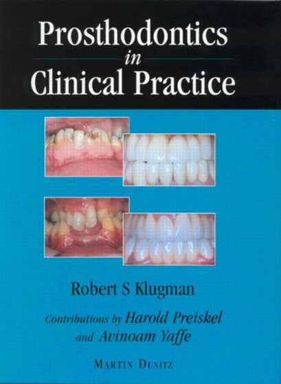 Prosthodontics in Clinical Practice by Robert S. Klugman - Hardback