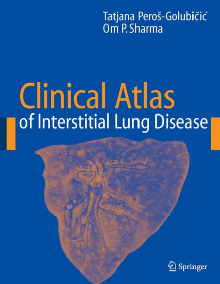 Clinical Atlas of Interstitial Lung Disease by Tatjana Peros-Golubicic - Hardback
