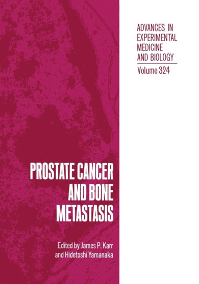 Prostate Cancer and Bone Metastasis : 324 by James P. Karr - Paperback