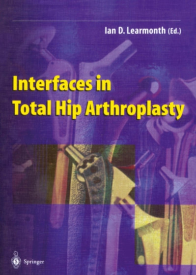 Interfaces in Total Hip Arthroplasty by Ian D. Learmonth - Paperback