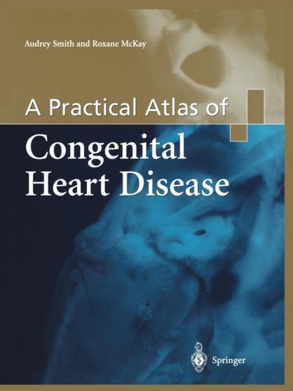 A Practical Atlas of Congenital Heart Disease by Audrey Smith - Paperback
