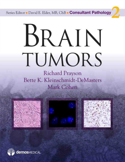 Brain Tumors by Richard Prayson - Hardback