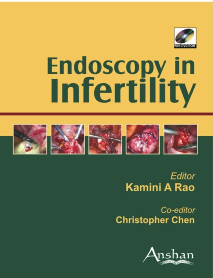 Endoscopy in Infertility by Kamini Rao - Hardback