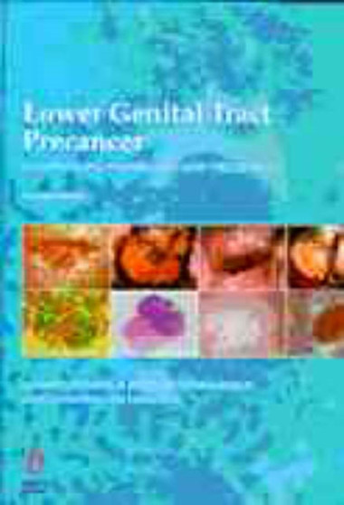 Lower Genital Tract Precancer by Albert Singer - Hardback