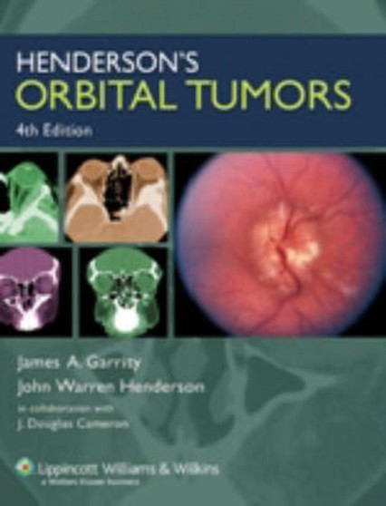 Henderson's Orbital Tumors by James A. Garrity - Hardback