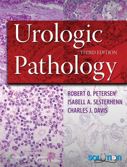Urologic Pathology by Robert O. Peterson - Hardback