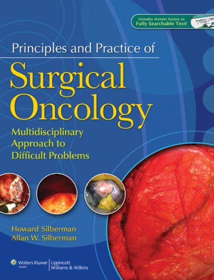 Principles and Practice of Surgical Oncology : A Multidisciplinary Approach to Difficult Problems by Howard Silberman - Hardback