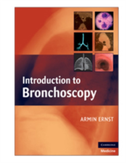 Introduction to Bronchoscopy by Armin Ernst - Hardback