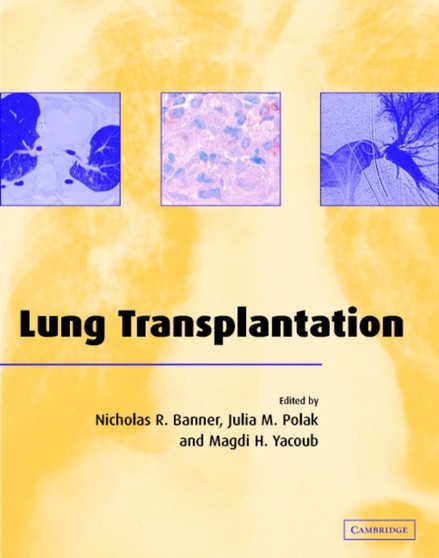Lung Transplantation by Nicholas R. Banner - Hardback