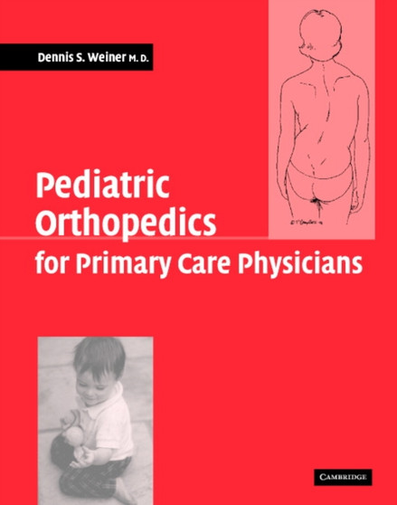 Pediatric Orthopedics for Primary Care Physicians by Dennis S. Weiner - Hardback
