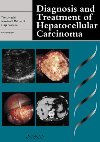 Diagnosis and Treatment of Hepatocellular Carcinoma by Tito Livraghi - Hardback
