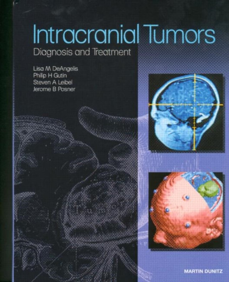 Intracranial Tumors : Diagnosis and Treatment by Lisa M. DeAngelis - Hardback