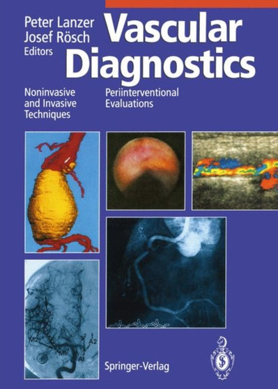 Vascular Diagnostics : Noninvasive and Invasive Techniques Periinterventional Evaluations by Peter Lanzer - Paperback