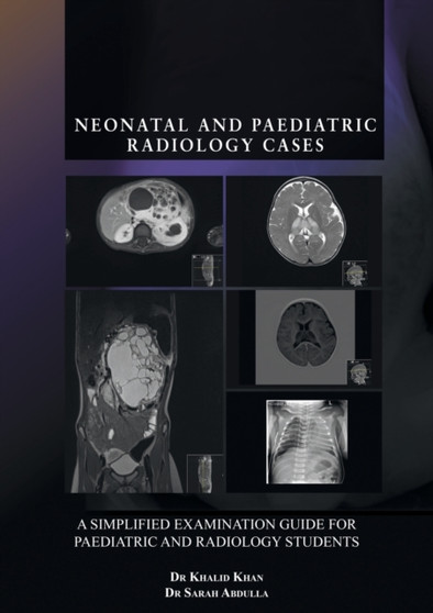 Neonatal and Paediatric Radiology Cases : A Simplified Examination Guide for Paediatric and Radiology Students by Khalid Khan - Paperback