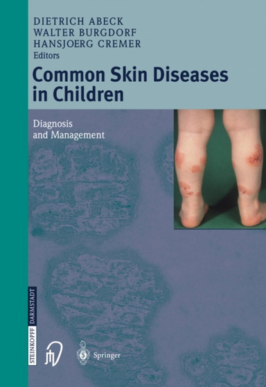 Common Skin Diseases in Children : Diagnosis and Management by Dietrich Abeck - Paperback