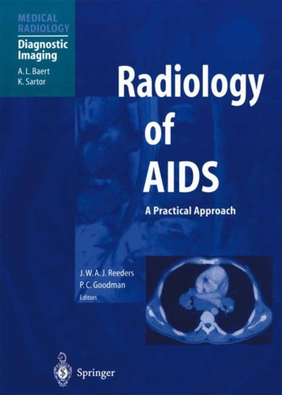 Radiology of AIDS by A.L. Baert - Paperback