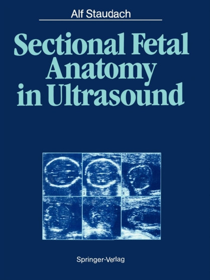 Sectional Fetal Anatomy in Ultrasound by Alf Staudach - Paperback