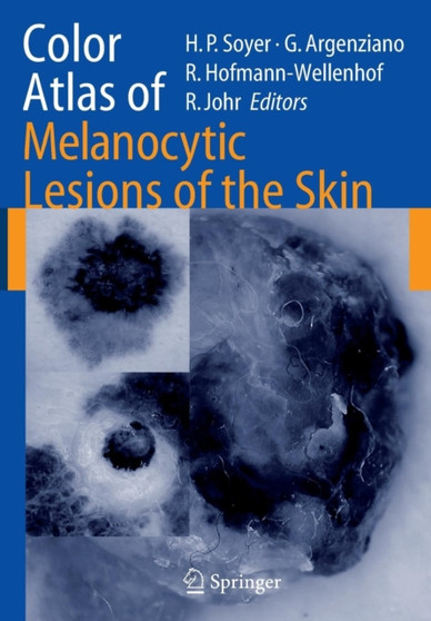 Color Atlas of Melanocytic Lesions of the Skin by H.Peter Soyer - Paperback